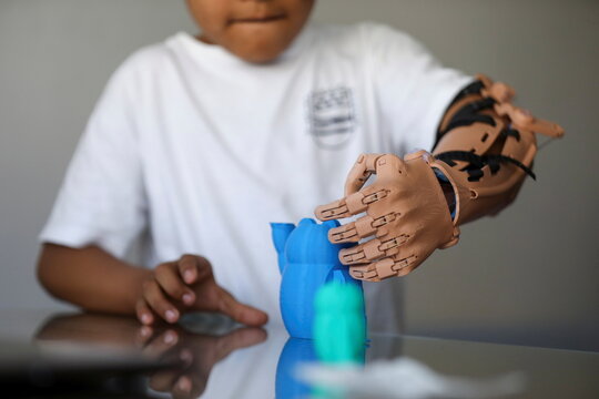 Moyolema, an 8-year-old boy who was born missing the lower part of his left arm, picks a toy up with a 3D printed tailor-made prosthetic in Spain