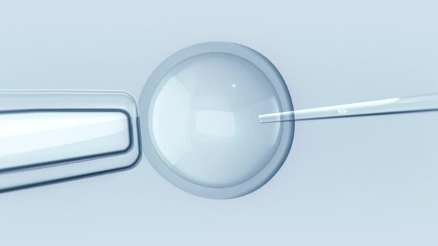 In vitro fertilization. View from a microscope, embryologist performing sperm Injection. Intracytoplasmic sperm injection. IVF. Loopable.