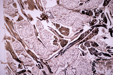 Characteristics of anatomy and Histological sample Striated (Skeletal) muscle of mammal Tissue under the microscope.
