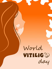 World Vitiligo Day poster. Beautiful woman with vitiligo. The vector is made in a flat style. Modern portrait in vector.