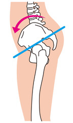 横から見た骨盤　O脚　骨盤の歪み