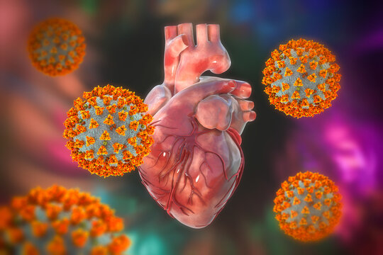 COVID-19 viruses affecting the heart, conceptual 3D illustration