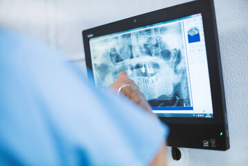 Clinica dental, radiografia