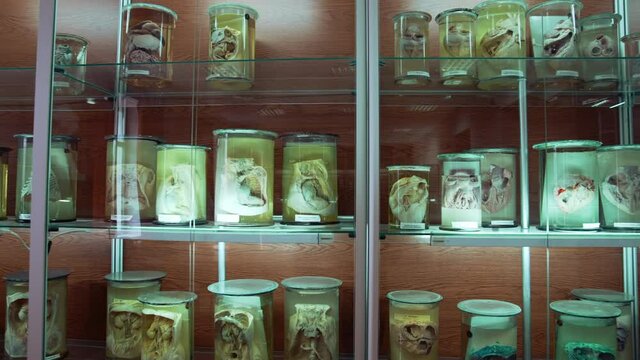 Large collection of human organs in anatomical museum. Different parts of internal organs preserved in formaldehyde on shelves. Scientific education.