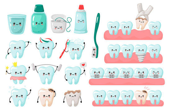 A great set of kavai teeth concepts. removal, cleaning, implantation, braces, teeth alignment. vector illustration in cartoon style.