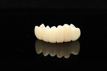 Dental zirconia bridge with porcelain baked