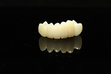 Dental zirconia bridge with porcelain baked