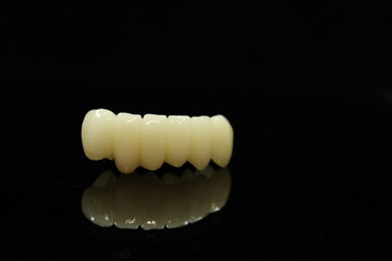 Dental zirconia bridge with porcelain baked