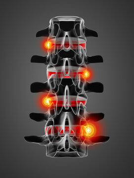 3D rendering illustration of intervertebral discs