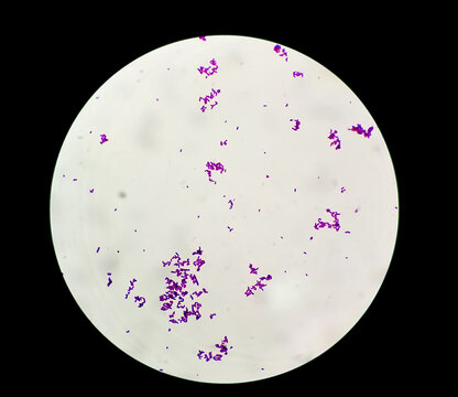 Gram-positive Bacteria Streptococcus Pyogenes Which Cause Scarlet Fever And Other Infections, 