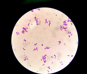 Gram-positive bacteria Streptococcus pyogenes which cause Scarlet fever and other infections, 
