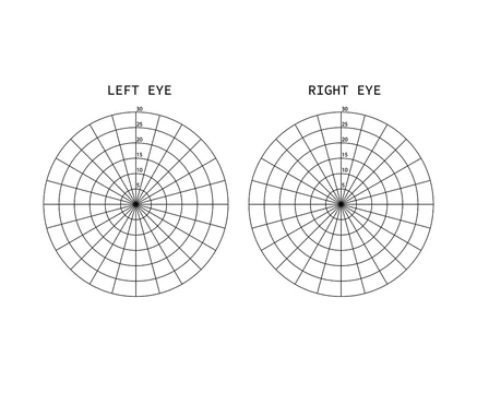 Amsler test grid. Eye scotoma chart. Oculist Vector printable