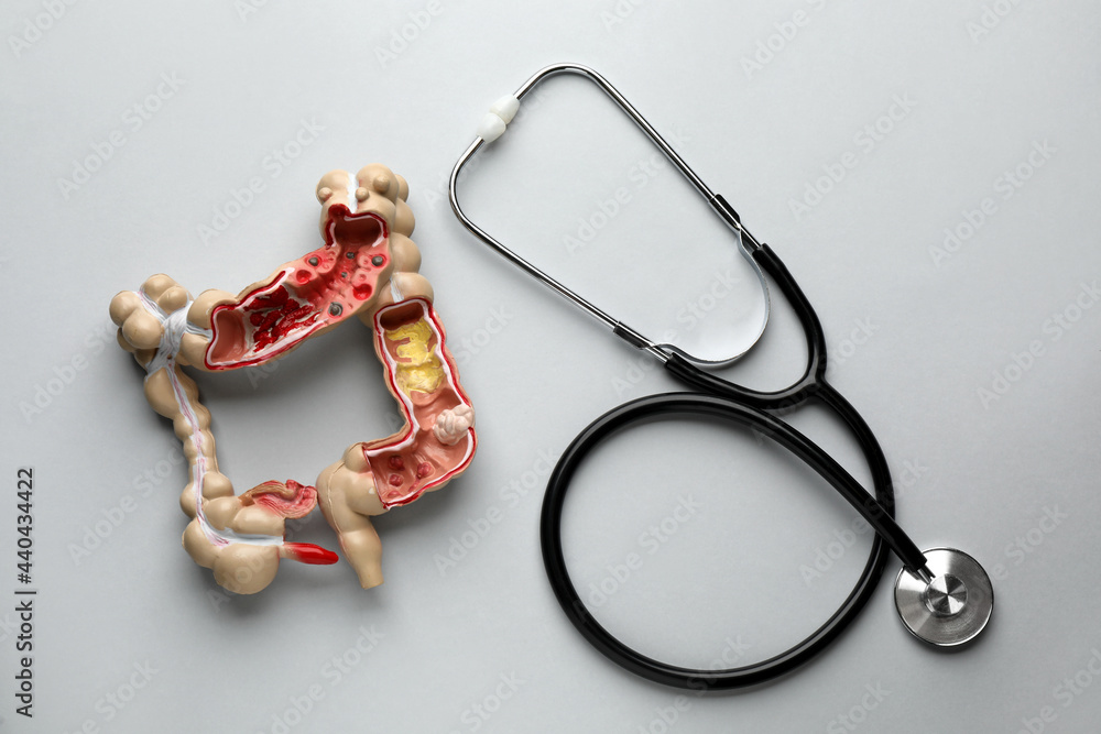 Sticker Anatomical model of large intestine and stethoscope on grey background, flat lay. Gastroenterology