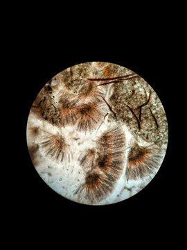 Slice of a mushroom with asci with ascospores through a microscope. Mycological drug. Scutellinia scutellata