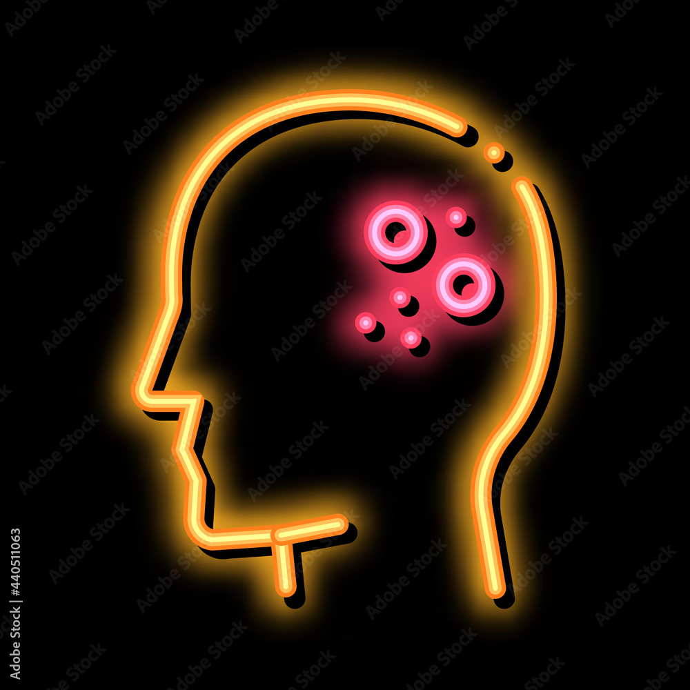 Poster main problem of dermatitis neon light sign vector. Glowing bright icon main problem of dermatitis sign. transparent symbol illustration