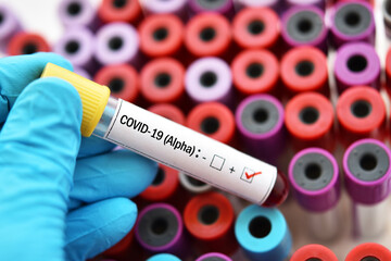 Obraz premium Alpha variant COVID-19 positive, blood sample tube positive with Alpha variant or UK strain COVID-19 