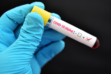 Obraz premium Alpha variant COVID-19 positive, blood sample tube positive with Alpha variant or UK strain COVID-19 