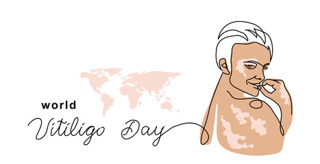 Vitiligo skin simple vector banner, poster, background. Person with skin pigmentation. One continuous line art drawing and lettering world vitiligo day