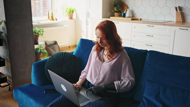 Woman deftly controls the touchscreen of the laptop with the fingers of the prosthesis. Happy ginger girl with artificial limb working with a laptop at home