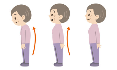 背中の曲がったシニア女性のビフォーアフター