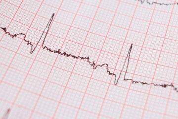 Heart electrocardiogram EKG chart on special paper. Concept for heart scan, health insurance, medical background, examination.
