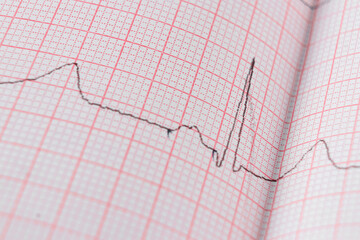Heart electrocardiogram EKG chart on special paper. Concept for heart scan, health insurance, medical background, examination.