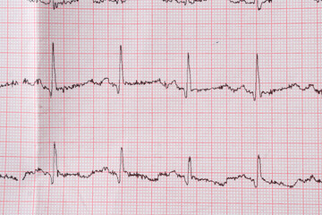 Heart electrocardiogram EKG chart on special paper. Concept for heart scan, health insurance, medical background, examination.