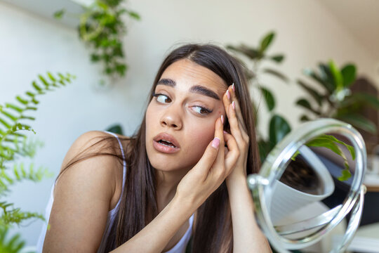 Conceptual Shot Of Acne And Problem Skin On Female Face. Cropped Shot Of A Young Woman Squeezing A Pimple On Her Face