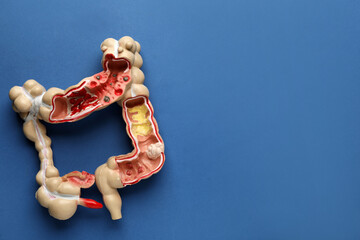 Fototapeta premium Anatomical model of large intestine on blue background, top view with space for text. Gastroenterology
