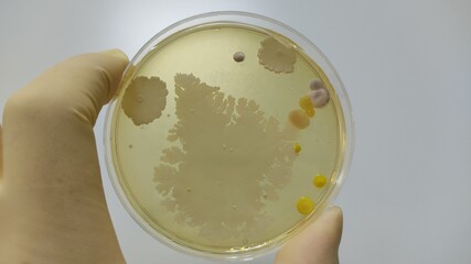 Quality control microorganism test mold culture result