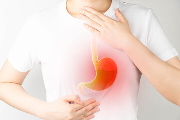 Gastroesophageal reflux disease (GERD) or acid reflux symptoms. Woman suffering from heartburn, stomachache, nausea and bloating. Gastrointestinal system disease and digestive problems. - obrazy, fototapety, plakaty