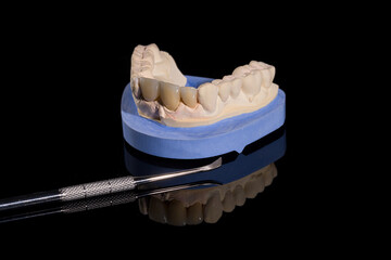 Close up of artificial dentition on a dental imprint ready to use with a tool, working result of a...