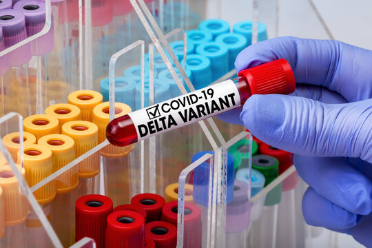 Doctor epidemiologist holding blood tube for test detection of virus Covid-19 Delta Variant with positive result. Doctor testing blood test tube from patient infected with Coronavirus Delta variant
