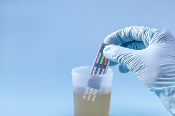 a woman's hand drops test strips into a jar of urine to detect illegal drugs and alcohol in the human body