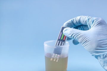 a woman's hand drops test strips into a jar of urine to detect illegal drugs and alcohol in the...