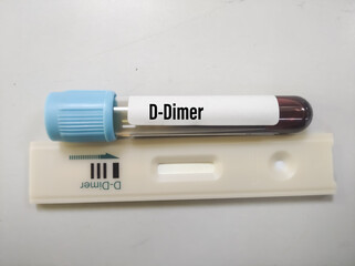 Close up view a device and sample tube of D-Dimer rapid screening test. Covid-19 patient monitoring...