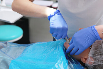 The orthodontist removes the braces. Steel wire cutters in hand.Removing parentheses. Bite correction. Incorrect growth of teeth. Hands in protective gloves.