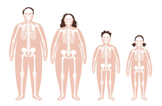 Obese skeleton anatomy