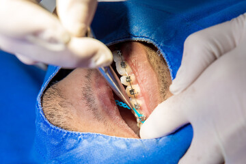 Orthodontics in dental clinic