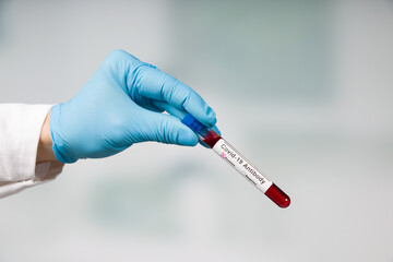 hand in medical gloves holding a blood test tube for antibody analysis with positive result markers...