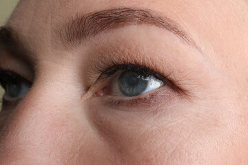 Fototapeta na wymiar Closeup view of mature woman with eye cataract
