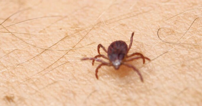 Small Insect Parasite Mite Rotate and Crawls On a Man's Arm Macro Shot. Tick on the Skin Close Up. Ticks Carry Encephalitis Disease. Blood-sucking Mite Tick Creepers on the Human Skin Through the Hair