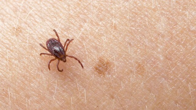 Small Insect Parasite Mite Crawls On a Man's Arm Macro Shot. Tick on the Skin Close Up. Ticks Carry Encephalitis Disease. Blood-sucking Mite Tick Creepers on the Human Skin Through the Hair