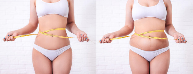 Women's body before and after weight loss, liposuction, diet concept. A woman measures her waist with a tape centimeter