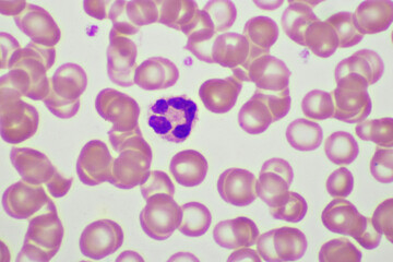 Segmented neutrophil cell in human blood smear, analyze by microscope, original magnification 1000x