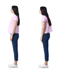 Young woman with bad and proper posture on white background - obrazy, fototapety, plakaty