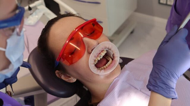 Installing braces at the orthodontist, measuring degrees, orthodontics, side view