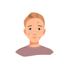 A sad teenager due to acne problems. Vector illustration in cartoon style.