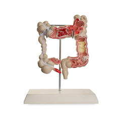 Anatomical model of large intestine isolated on white. Gastroenterology