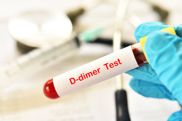Blood sample tube for D-dimer test, diagnosis for intravascular thrombosis after COVID-19...